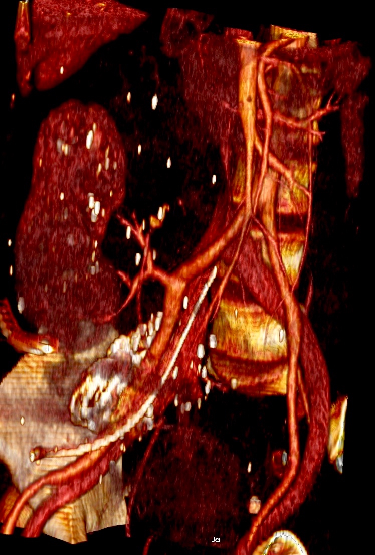 Obraz 3d VR po operacji